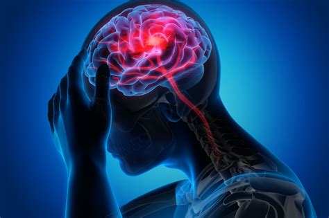 The Personal And Economic Burden Of Traumatic Brain Injury Glendale