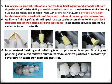 Dos And Donts In Dentistry Polishing Composite Restorations Easy