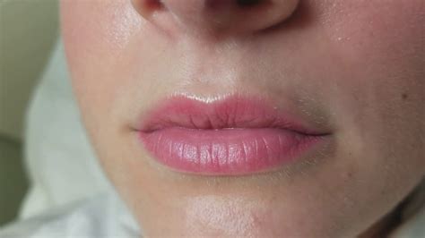Permanent Lip Color Tattoo Healed Youtube