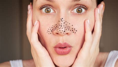 Blackhead Removal What Are Blackheads And Reasons For Blackheads Nykaa