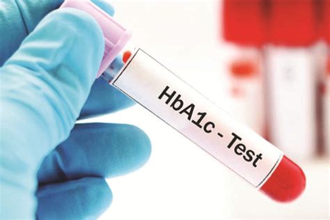 Hba1c Hemoglobin A1c Test For Diabetes Diagnosis Mtatva Health Pie