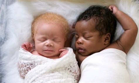 Photographer Gives Birth To Twins One Black The Other