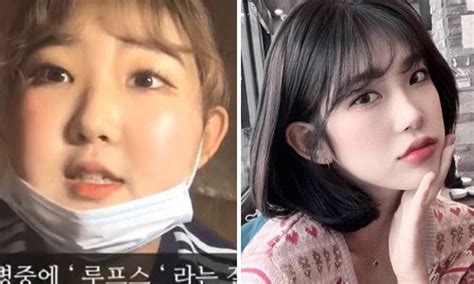 con gái nữ diễn viên quá cố choi jin sil lột xác sau khi giảm 44kg nhưng sao vẫn ham hố phẫu
