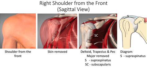 Rotator Cuff Disease Cambridge Shoulder