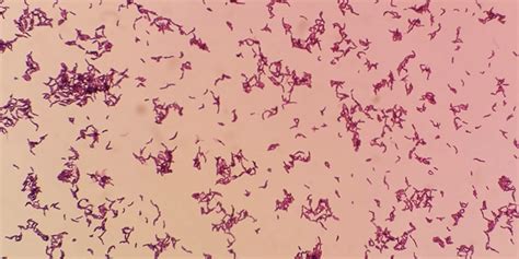 Propionibacterium пропионовокислые бактерии или пропионибактерии