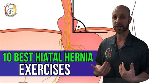 10 Best Hiatal Hernia Exercises Youtube In 2022 Hernia Exercises