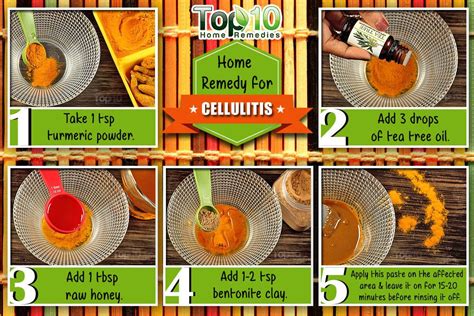 Home Remedies For Cellulitis Top 10 Home Remedies
