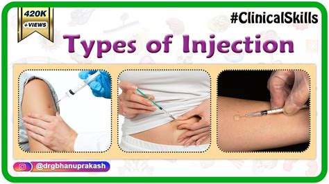 Types Of Injection Sites Techniques Intra Muscular Intra Dermal