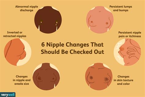 Abnormal Skin Changes On Nipples In Pregnancy Ncee