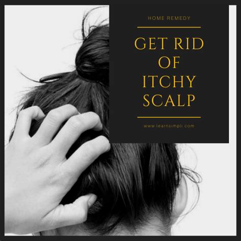 How To Get Rid Of Itchy Scalp A Simple Home Remedy