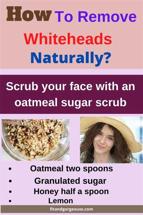 How To Remove Whiteheads Naturally 5 Effective Remedies For You
