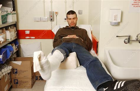 Man With Leg In Plaster Cast Stock Image C0549185 Science Photo