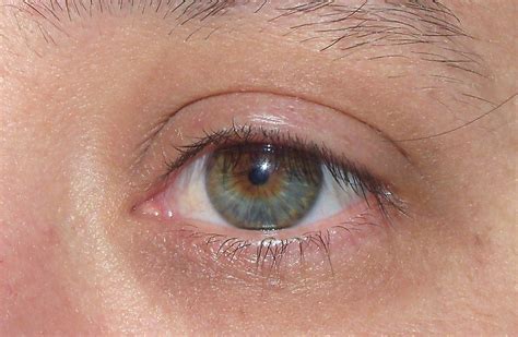 The common wrong form heterochromia iridium is not correct latin) is of central heterochromia is an eye condition where there are two colors in the same iris; hazel eyes - central heterochromia | I was born with dark ...