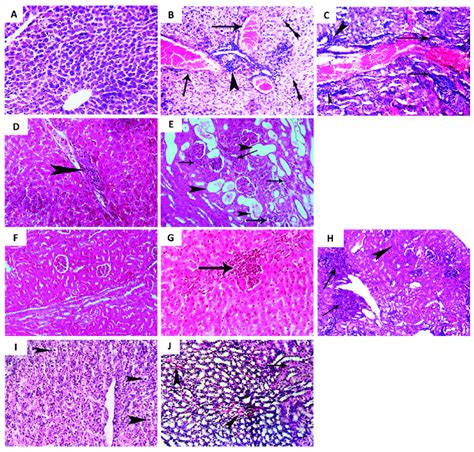 Histopathological Examination Of Liver And Renal Tissues Five Groups
