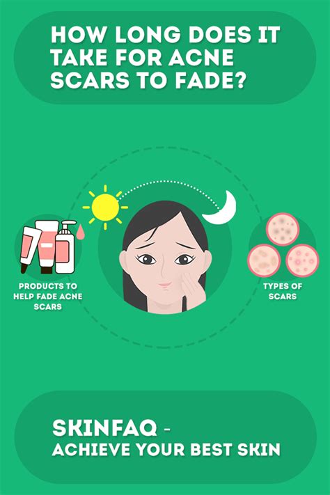 Pin On Acne Scars