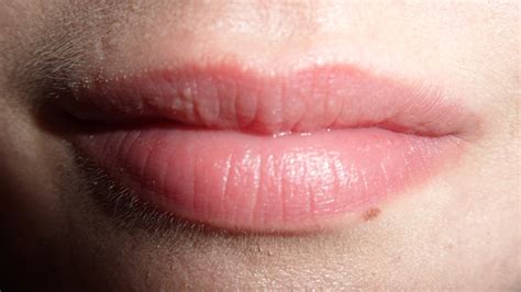 White Spot On Lips Due To Smoking