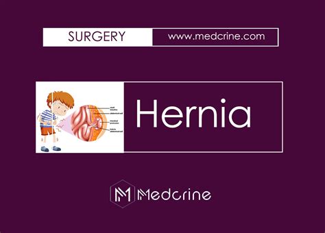 Composition Classification And Clinical Features Of Hernia Medcrine