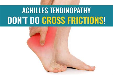 Dont Do Cross Frictions Massage On Your Achilles Tendon Treat My Achilles