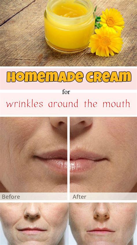 Homemade Cream For Wrinkles Around The Mouth An Immersive Guide By