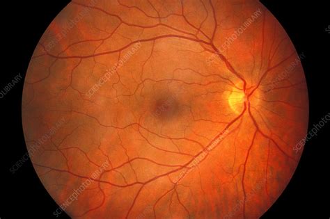 Healthy Eye Fundus Image Stock Image C0261047 Science Photo Library