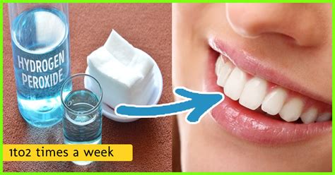 The Best Ways To Whitening Your Teeth At Home Naturally Garden