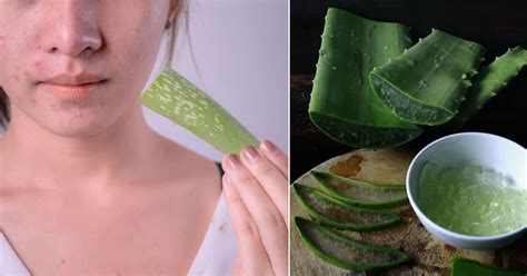 Aloe vera gel benefits are numerous. 5 Benefits of Applying Aloe Vera Gel on Face Overnight ...