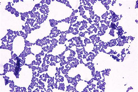 Staphylococcus Aureus Under Microscope Staphylococcus Aureus Gram