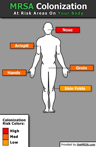 Mrsa Colonization Mrsa Infection Control Nursing Sick Remedies