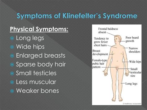 ppt klinefelter s syndrome powerpoint presentation free download id 963511