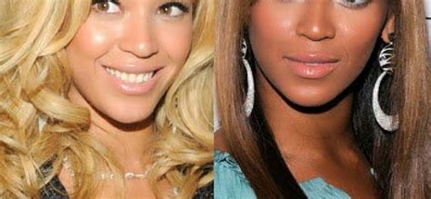 Nicki Minaj Before And After Bleaching Beyonce As Pure As Gold VitaminCSkincare