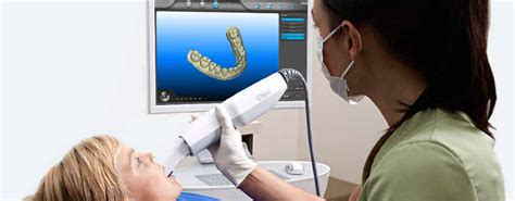 El Escáner Intraoral 3d La Revolución En La Clínica Dental Aguilar Salut