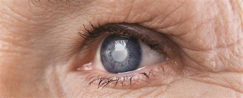 Choosing A Multifocal Lens For Cataract Surgery Eye Center Of Texas