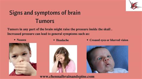 Symptoms Of Eye Cancer In Child Brain Tumor Symptoms In Teenagers