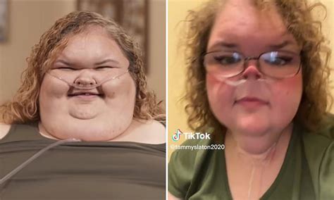 1000 Lb Sisters Star Tammy Slaton 36 Shows Off Her New Look Daily