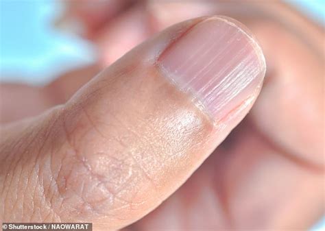 Australian Experts Reveal Common Nail Problems And What These Say About