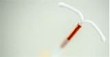 Pictures of Iud Birth Control Brands