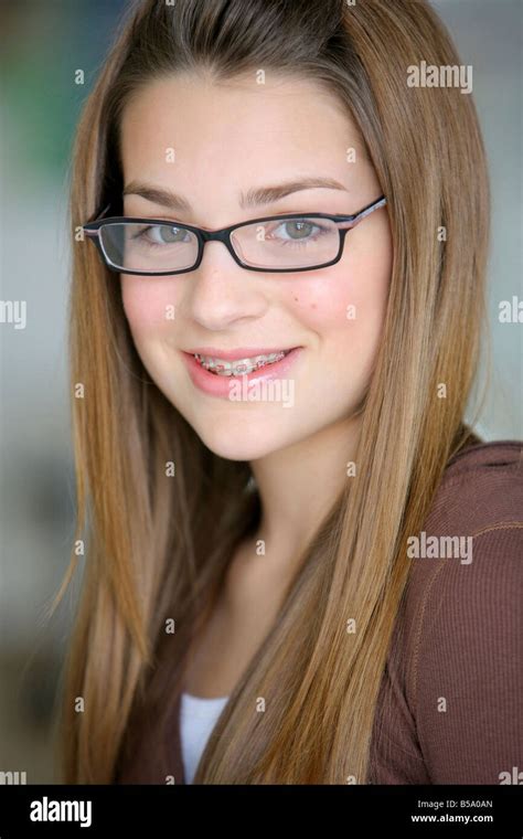 Young Girl With Glasses And Braces Stock Photo Alamy