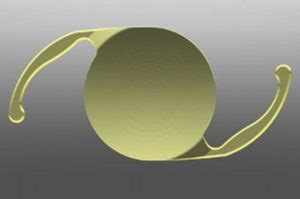Alcon Panoptix Iol Denver Cutarelli Vision Cataract Lens Implant