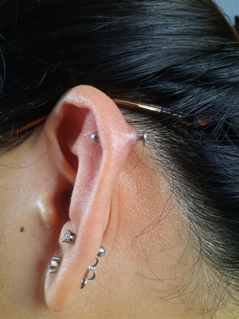 piercing bump or infection had my helix for almost a year now and this just happened recently