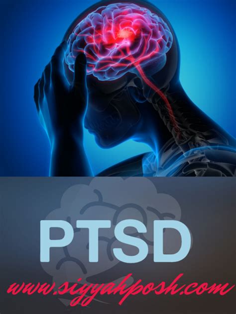 What Is PTSD Post Traumatic Stress Disorder