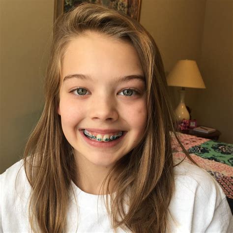 Whitney Bjerken On Instagram “i Got Braces Today Braceface 😬😬