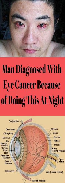 Man Diagnosed With Eye Cancer Because Of Doing This At Night