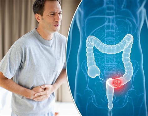 Symptoms Of Bowel Cancer Five Signs You Could Have The Disease