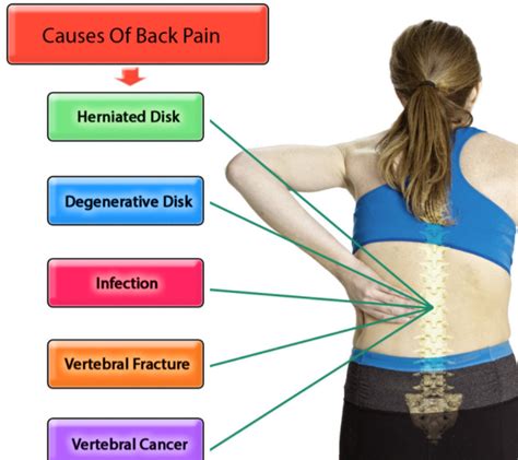 Causes Of Back Pain What Causes Back Pain Healthnormal