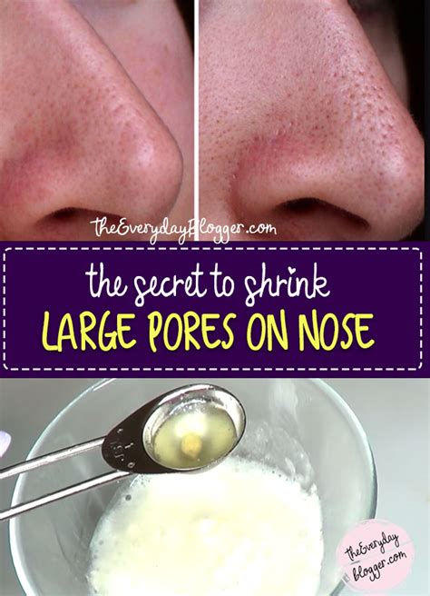 How To Shrink Large Pores On Nose The Everyday Blogger