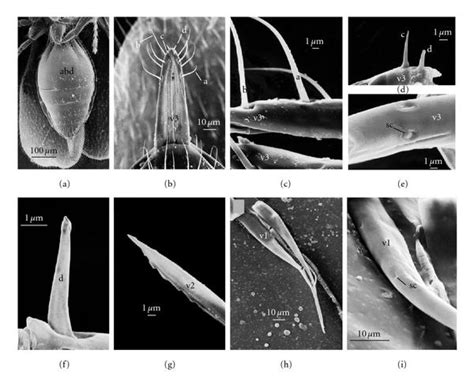 Figure Comparative Study Of The Morphology Of The Ovipositor Of Platygaster Diplosisae