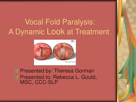 Ppt Vocal Fold Paralysis A Dynamic Look At Treatment Powerpoint