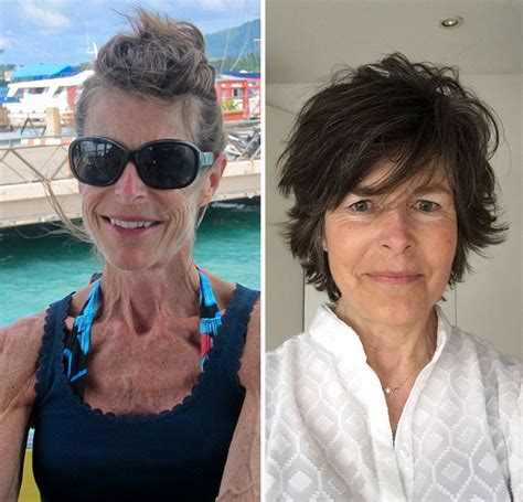 10 mujeres anoréxicas que compartieron el ‘antes y después de su recuperación [fotos] aweita pe