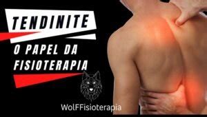 Tendinite No Ombro Que Causa Sintomas No Pesco O E Tratamento Wolf