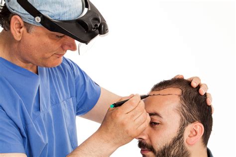 Who Is The Best Hair Transplant Doctor In Delhi Inewstelegraph